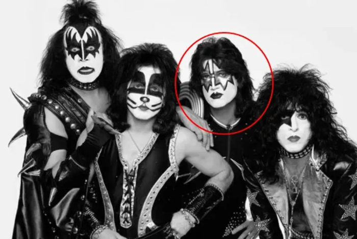 Causa de muerte de Ace Frehley: Trauma craneal por caída