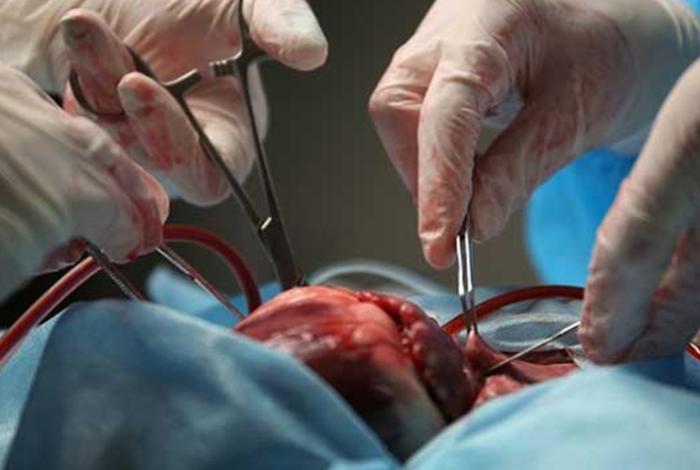 El Vaticano pide legislar sobre trasplantes de animales