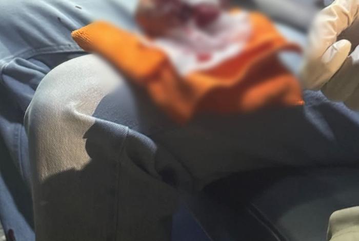 Explota pirotecnia en mano de un hombre durante festejos navideños en Uruapan; sufre severas afectaciones