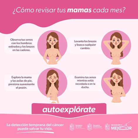 #Foto | Reconoce los síntomas del cáncer de mama para actuar de inmediato