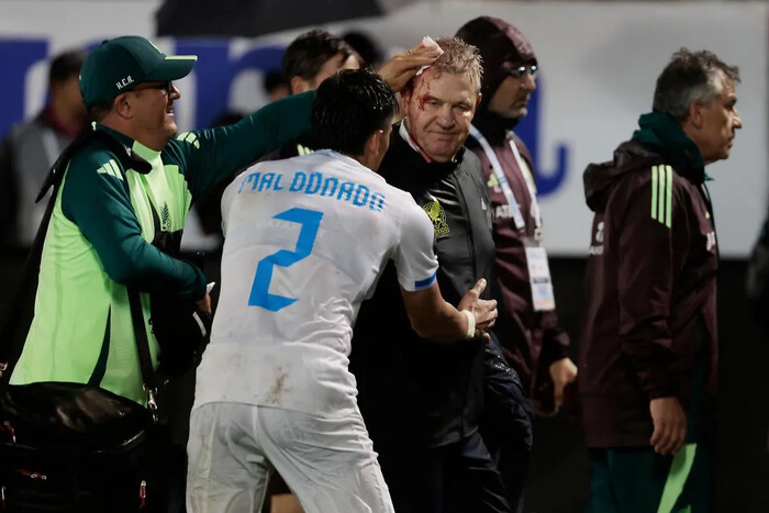 México registra descalabro de 2-0 ante Honduras