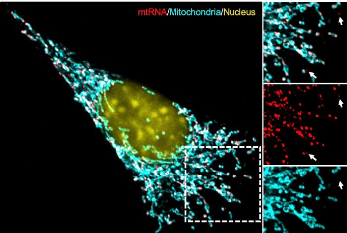 ¿Qué hace el sistema inmune ante un tumor? Científicos revelan mecanismo de defensa