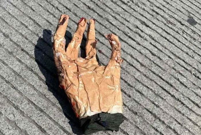 Reporte sobre hallazgo de mano humana moviliza a la Policía en Villas del Pedregal