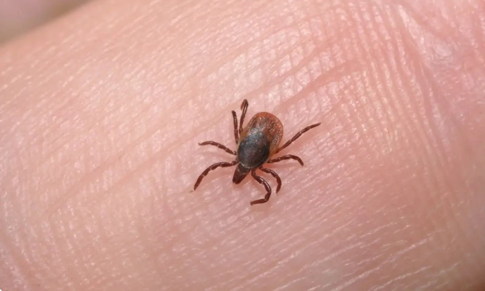 Sonora reporta 18 fallecimientos y 38 casos confirmados de rickettsia en lo que va del año