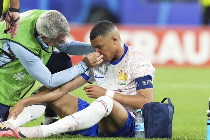 #Video | Mbappé se fracturó la nariz en el debut de Francia y podría perderse el resto de la Euro